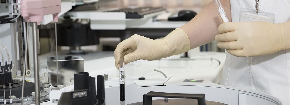 Čo prináša navrhovaná revízia farmaceutických právnych predpisov Európskej Únie?